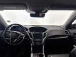 2015 Acura TLX V6 Tech
